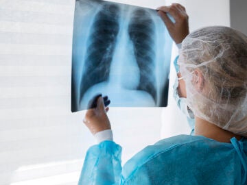 Médico revisando radiografía