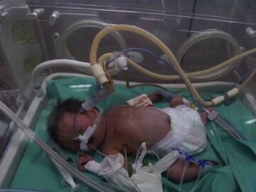 Un neonato en un hospital de Gaza
