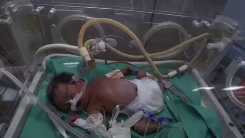 Un neonato en un hospital de Gaza Un neonato en un hospital de Gaza