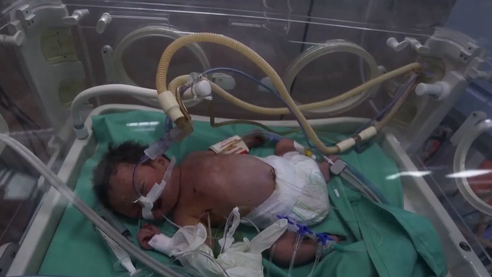 Un neonato en un hospital de Gaza Un neonato en un hospital de Gaza