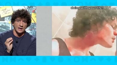 Jero García alerta a los jóvenes de los riesgos del reto 'rompe huesos' en Tik Tok: 