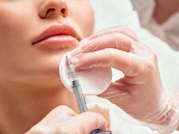 Inyección de ácido hialurónico en los labios