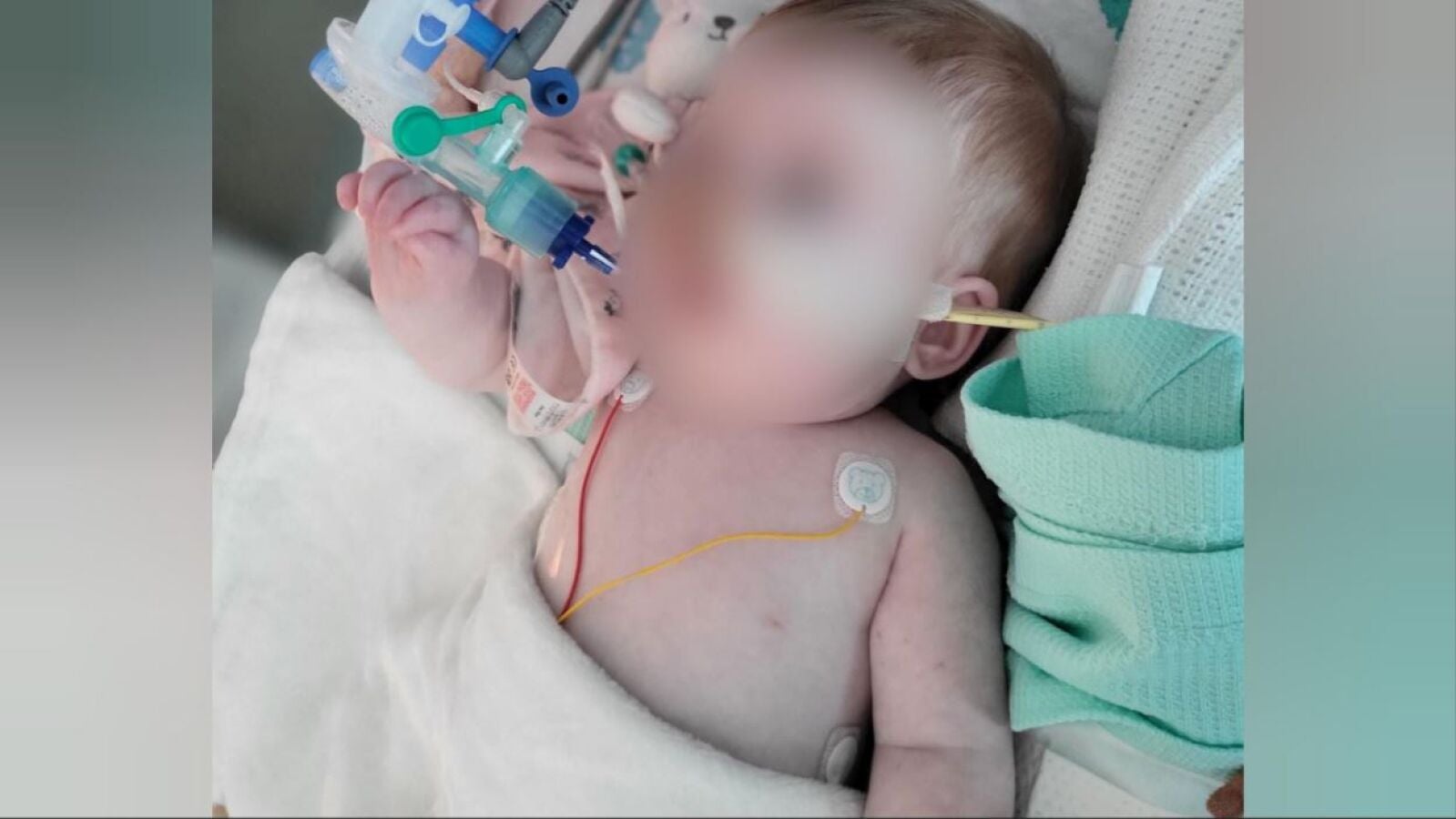 Muere Indi Gregory, la bebé con una enfermedad terminal, tras retirarle la respiración asistida