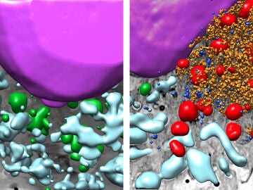 Imágenes tridimensionales de un fragmento de célula sana (izq.) y una infectada con SARS-CoV-2 dcha.) | CSIC