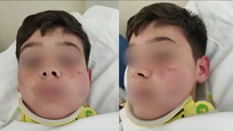 Las lesiones de Iker Las lesiones de Iker