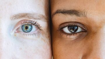 Ojos