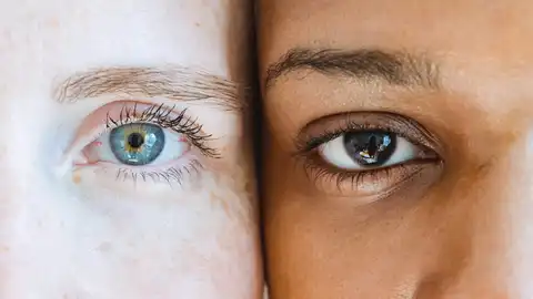 Ojos Ojos
