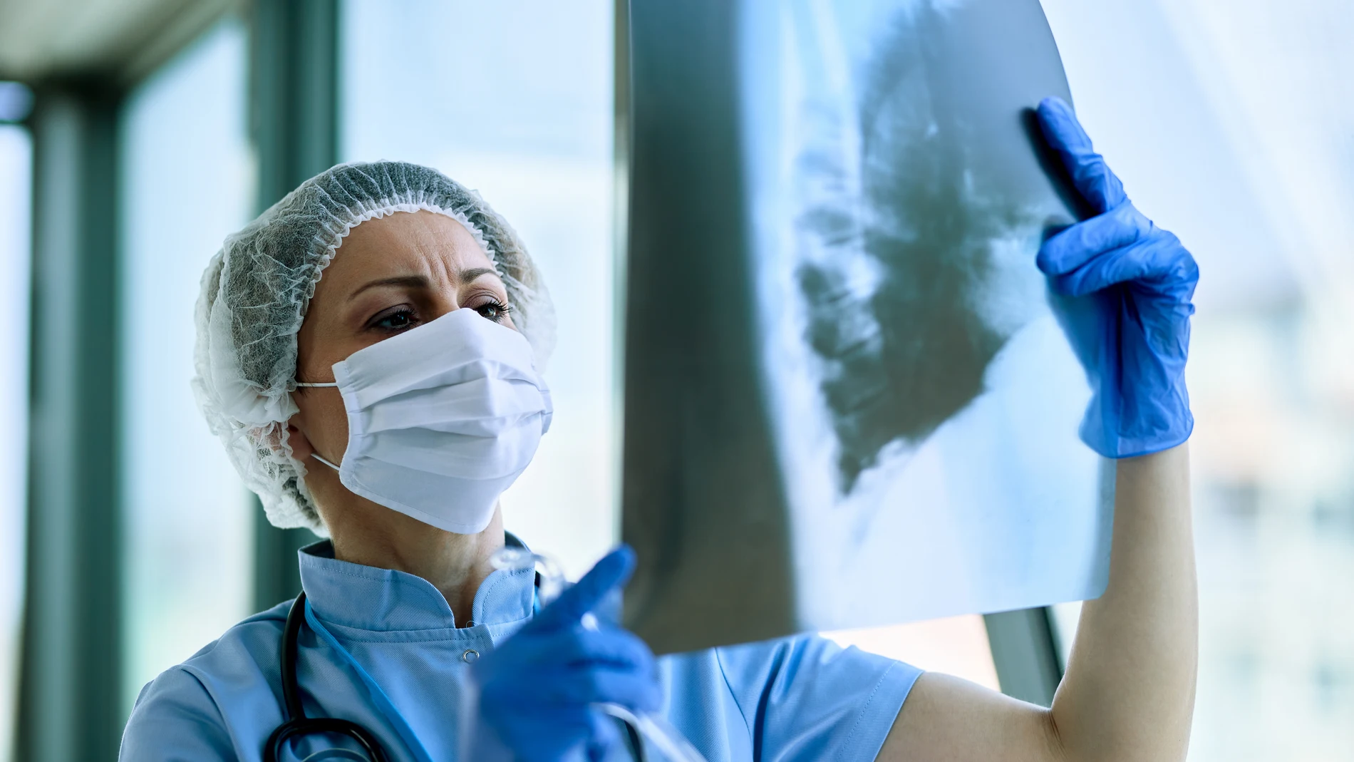 Una doctora revisando una radiografía de pulmones