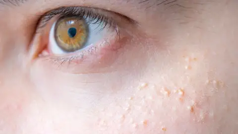 Granitos blancos Granitos blancos