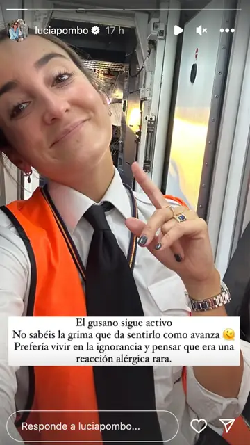 Lucía Pombo actualiza el estado del gusano de su pie Lucía Pombo actualiza el estado del gusano de su pie