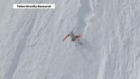 El esquiador Kai Jones muestra la secuencia del accidente en el que se fracturó las dos tibias