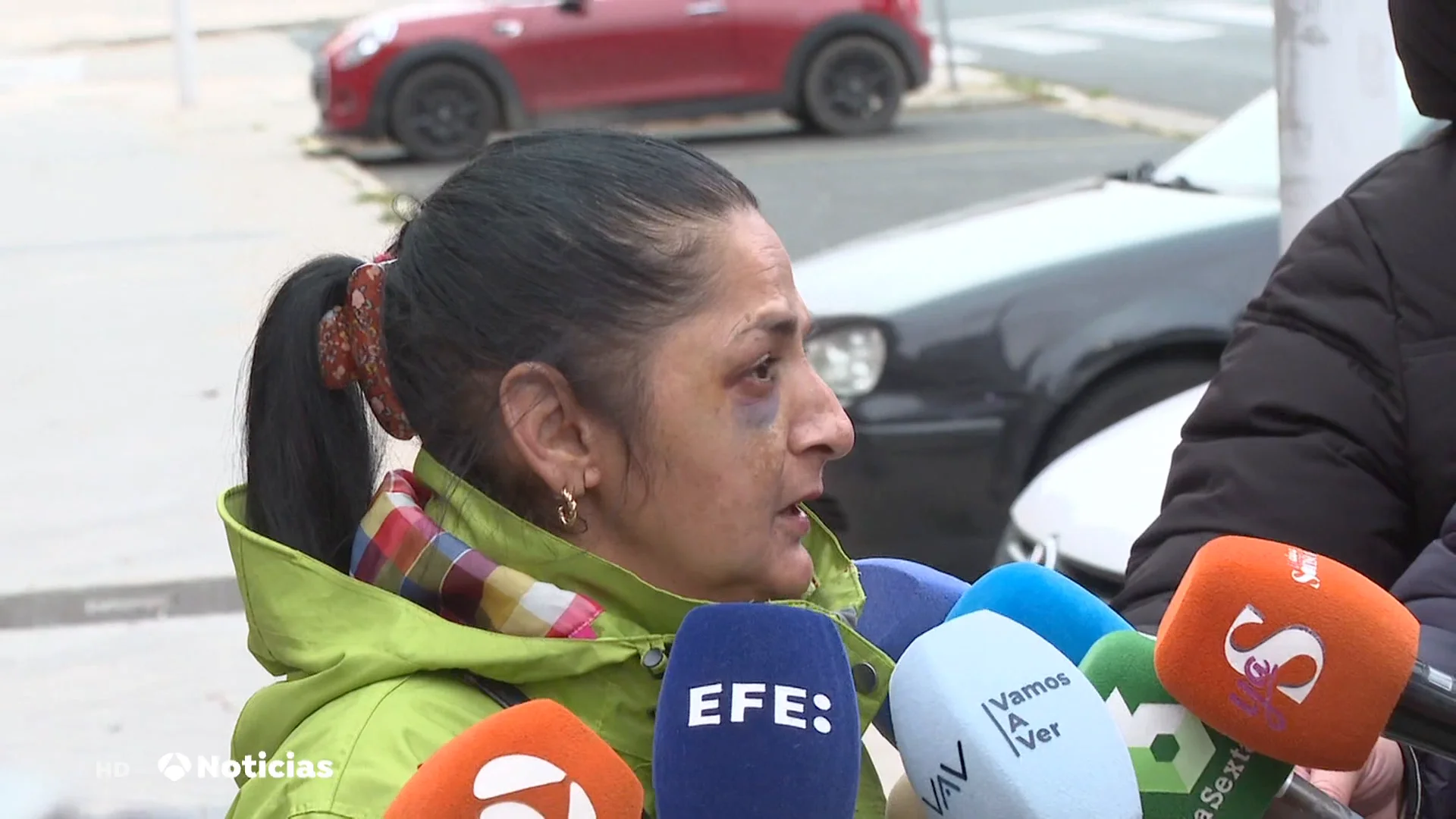 La mujer que apareci&oacute; encadenada en un hospital de Burgos no denunci&oacute; porque la ten&iacute;a amenazada 