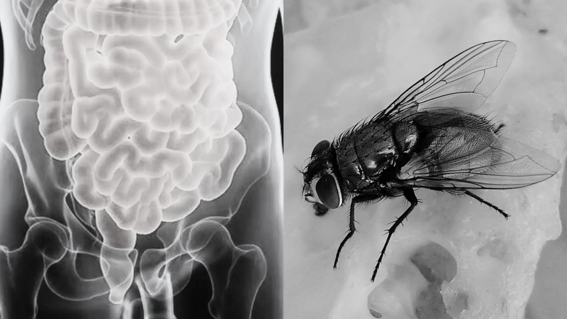 Imagen de un intestino y una mosca. Imagen de un intestino y una mosca.