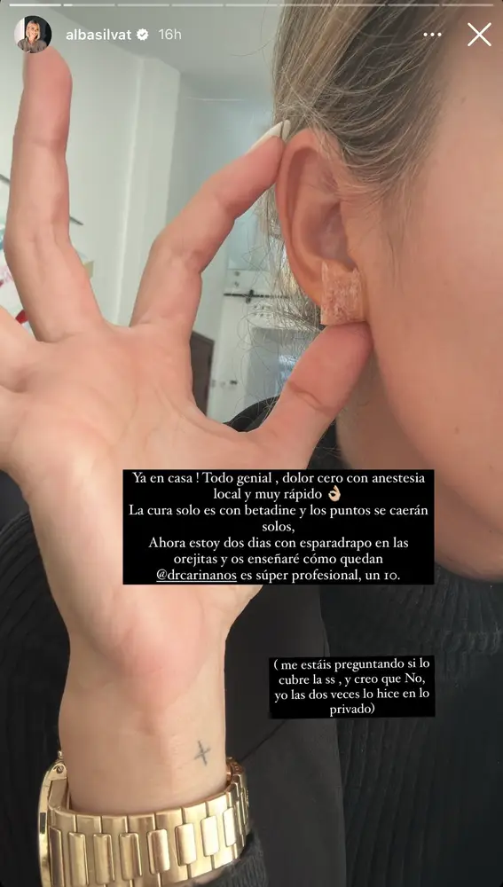 Alba Silva enseña sus orejas después de la cirugía