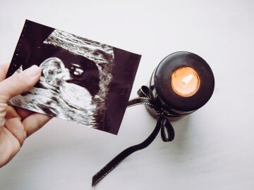 Ecografía de un bebé y una vela