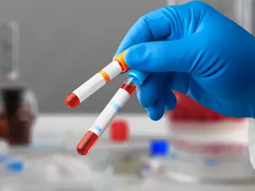 Análisis de sangre, envejecimiento, órganos Análisis de sangre, envejecimiento, órganos