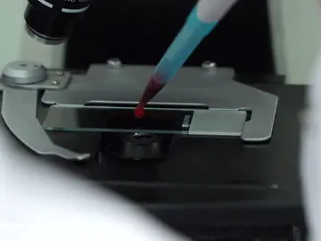 Un simple análisis de sangre permite saber cuándo y cómo envejecerán tus órganos Un simple análisis de sangre permite saber cuándo y cómo envejecerán tus órganos