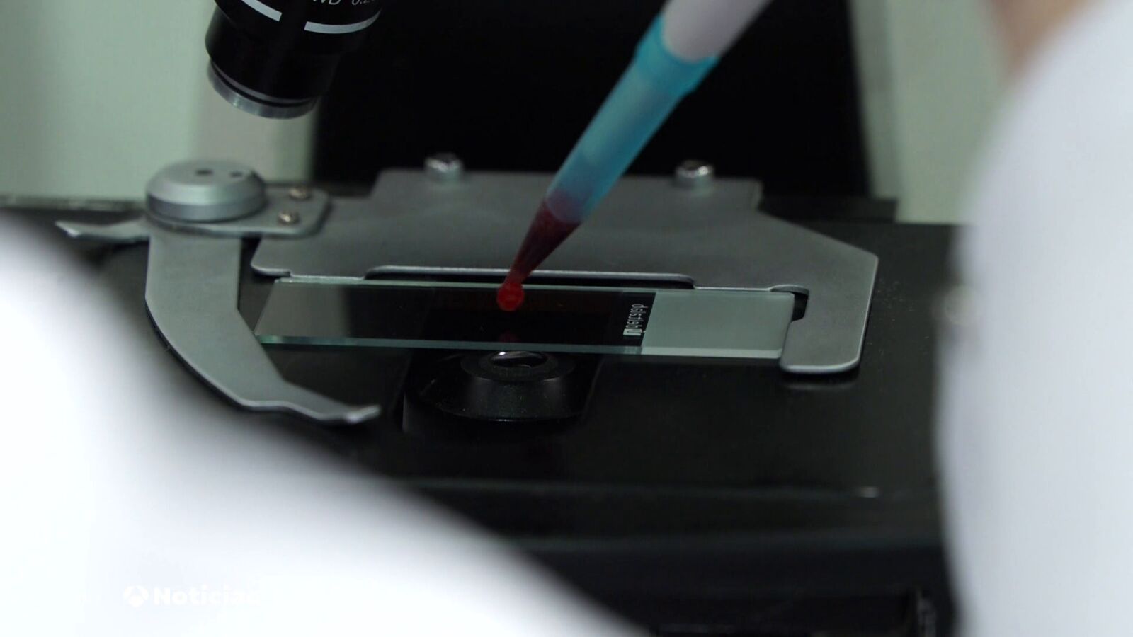 Un simple análisis de sangre permite saber cuándo y cómo envejecerán tus órganos