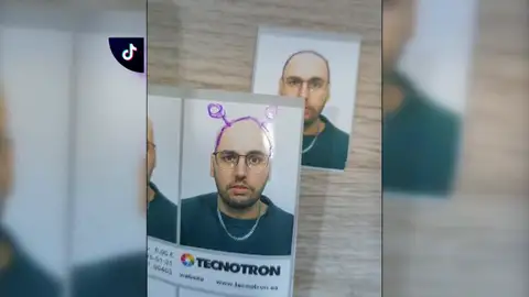 Ser calvo se convirtió un problema para Dani cuando fue a renovarse el DNI: "Acepté para no repetir trámites" Ser calvo se convirtió un problema para Dani cuando fue a renovarse el DNI: "Acepté para no repetir trámites"