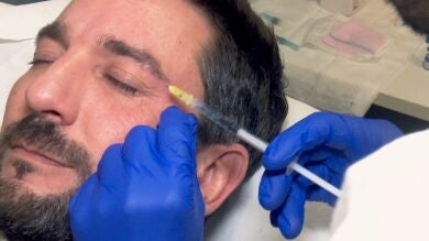 Diego Revuelta muestra el lado más desconocido de la cirugía estética: Así son las 'Botox Party'
