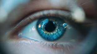 Imagen de un ojo