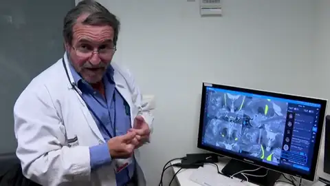 Implantan por primera vez un dispositivo que alivia los síntomas del párkinson Implantan por primera vez un dispositivo que alivia los síntomas del párkinson