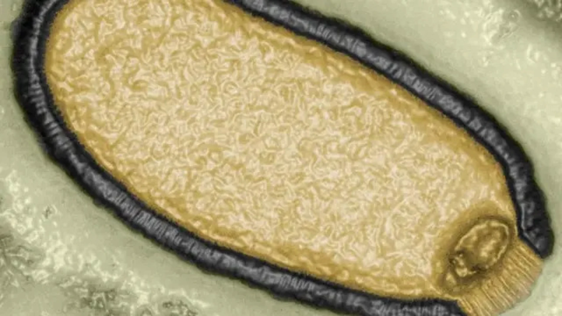 Imagen del virus Pithovirus sibericum