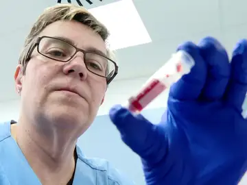 Análisis de sangre Análisis de sangre