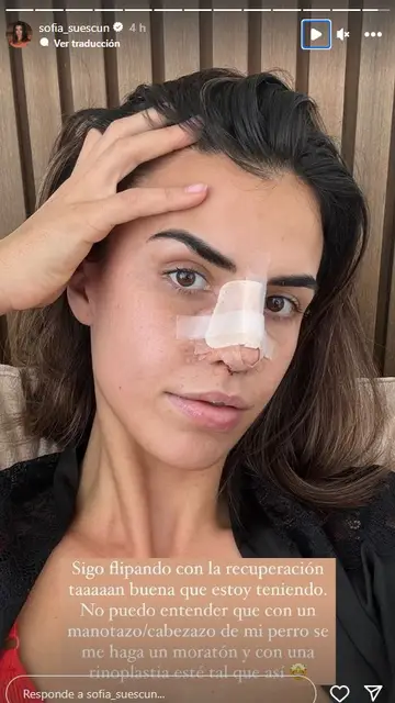 Sofía Suescun comparte cómo está siendo su recuperación de la rinoplastia Sofía Suescun comparte cómo está siendo su recuperación de la rinoplastia