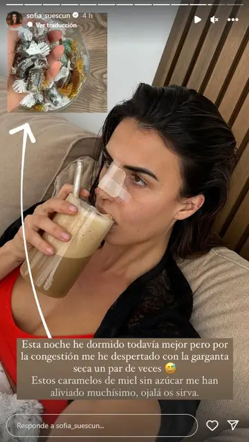 Sofía Suescun comparte cómo está siendo su recuperación de la rinoplastia Sofía Suescun comparte cómo está siendo su recuperación de la rinoplastia
