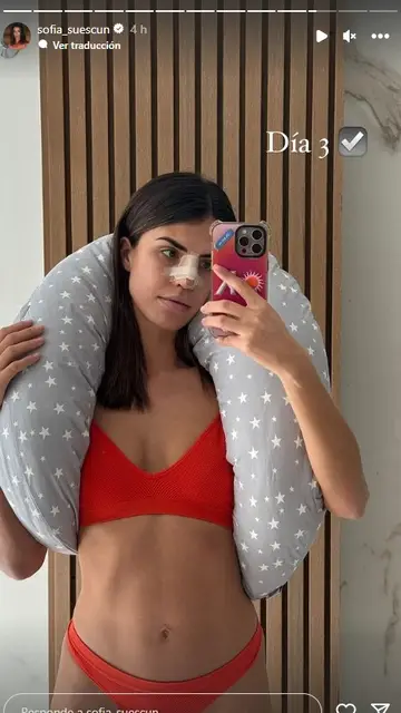 Sofía Suescun comparte cómo está siendo su recuperación de la rinoplastia Sofía Suescun comparte cómo está siendo su recuperación de la rinoplastia