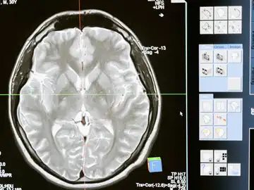 Cerebro imagen de archivo Cerebro imagen de archivo