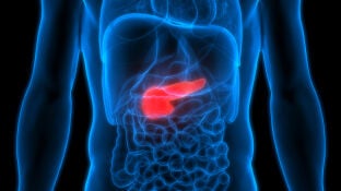 C&aacute;ncer de p&aacute;ncreas
