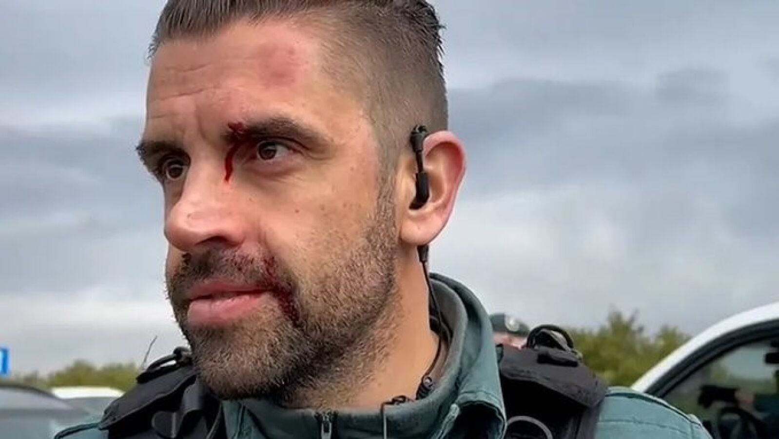 Un agente de la Guardia Civil resulta herido en las protestas por una pedrada en la cabeza de un agricultor