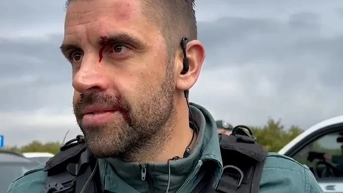 El agente herido El agente herido