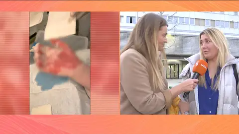 Un menor ingresado por fuertes quemaduras en su centro escolar: "Colapsó de dolor" Un menor ingresado por fuertes quemaduras en su centro escolar: "Colapsó de dolor"