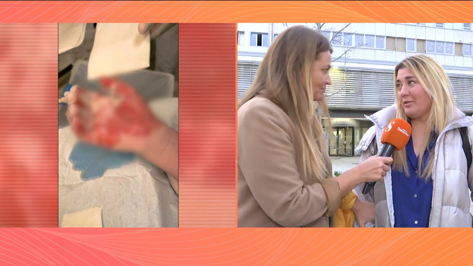 Un menor ingresado por fuertes quemaduras en su centro escolar: 