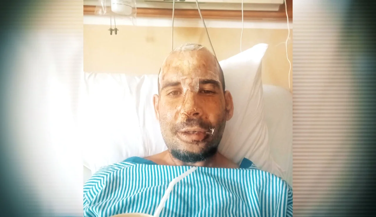Jaime, retenido en un hospital de Bali tras tener un accidente: "Me piden 15.000 euros para dejarme salir"