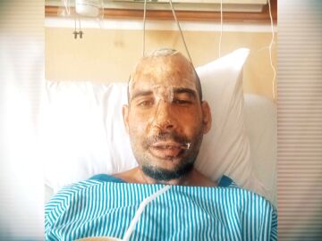 Jaime, retenido en un hospital de Bali tras tener un accidente: "Me piden 15.000 euros para dejarme salir"