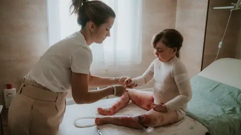 Loures, madre de una niña con Piel de Mariposa Loures, madre de una niña con Piel de Mariposa