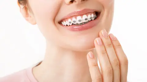 Una mujer con brackets Una mujer con brackets