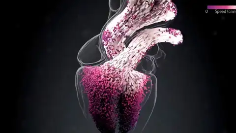 Corazones virtuales para personalizar tratamientosº Corazones virtuales para personalizar tratamientosº