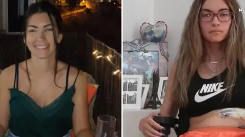 El antes y el después de Carolina