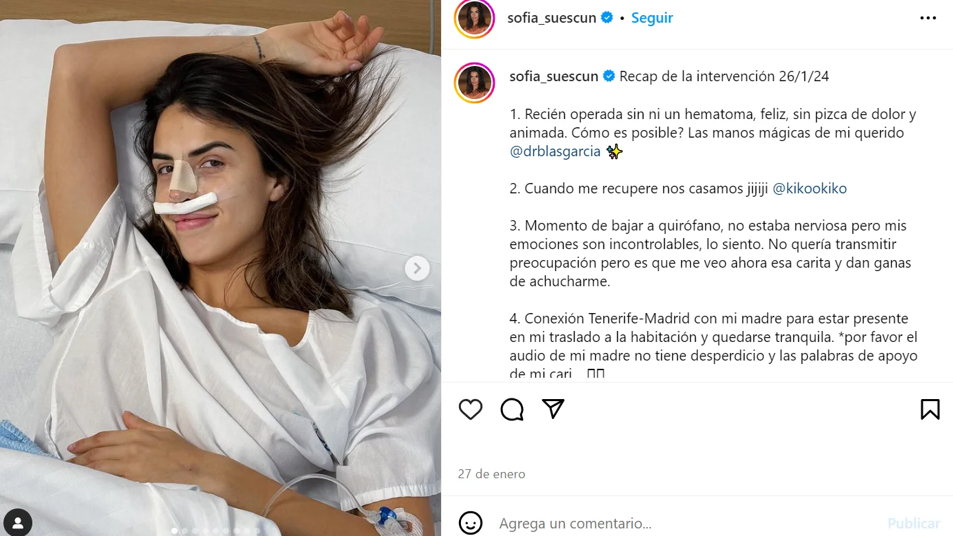Sofía Suescun operada de la nariz Sofía Suescun operada de la nariz