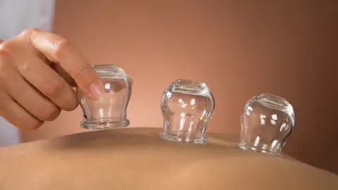 Vacumterapia Vacumterapia