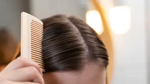 Cuero cabelludo Cuero cabelludo