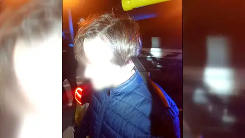 Sobrevive con un cuchillo de 50 centímetros clavado en la cabeza Sobrevive con un cuchillo de 50 centímetros clavado en la cabeza