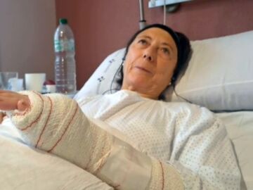 Desgarros en la piel y lesiones en las piernas: el resultado del ataque que sufrió Carmen por dos pitbulls sin vacunar