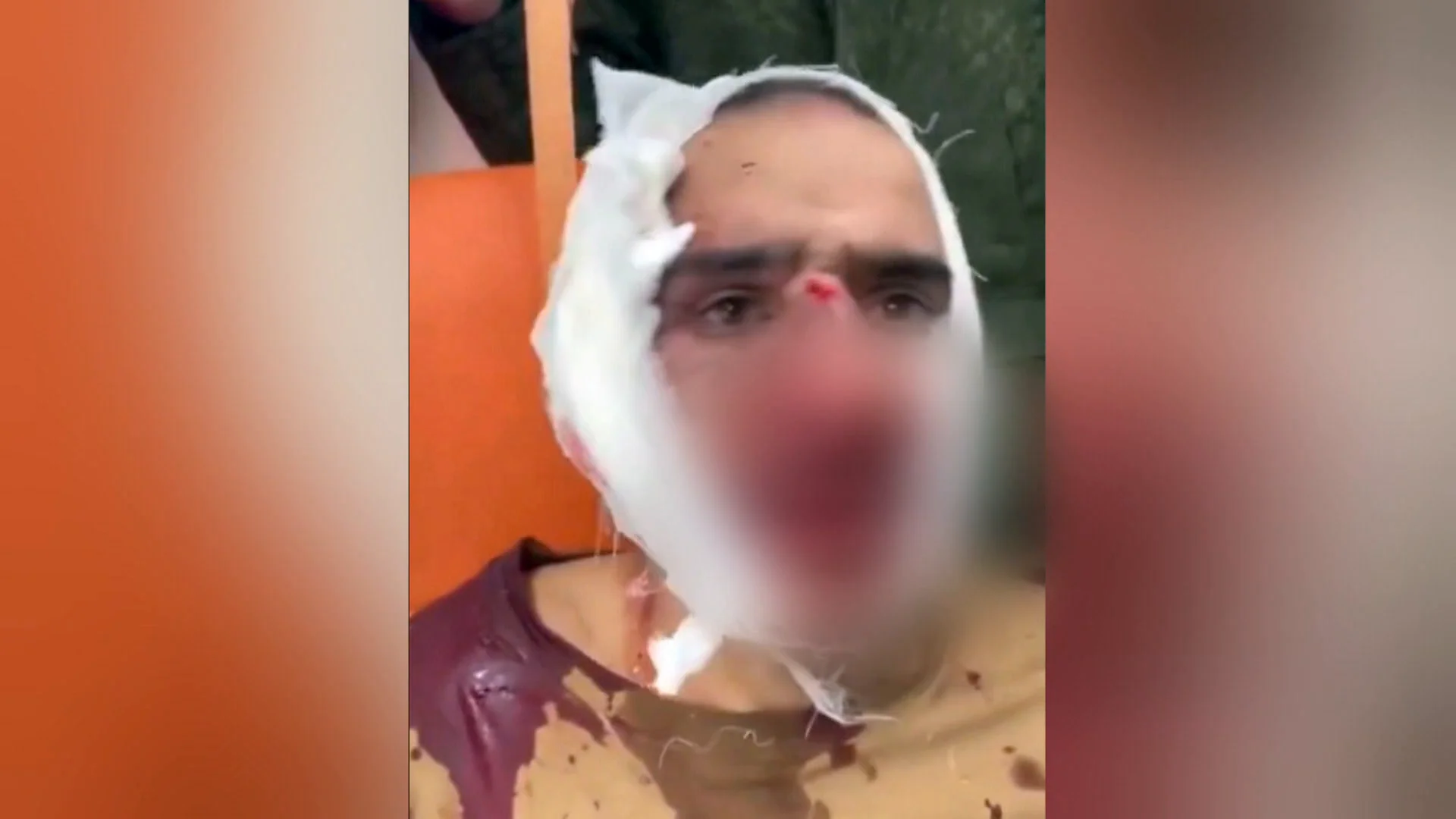 Uno de los detenidos en Moscú con la oreja cortada Uno de los detenidos en Moscú con la oreja cortada