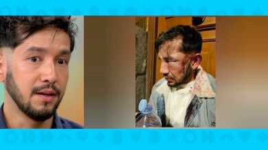 Pablo, víctima de una agresión homófoba: 